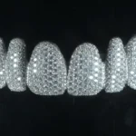 Grillz Veneer