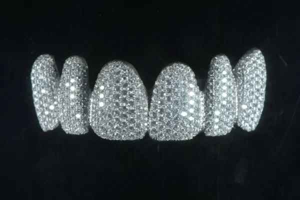 Grillz Veneer