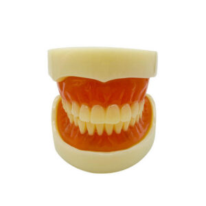How Should Anterior and Posterior Materials Be Coordinated in Full-Mouth Rehabilitation