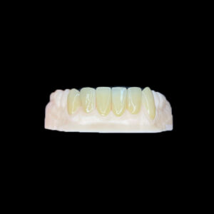 Multi-Veneer
