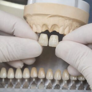 Is High-Translucency Zirconia Really Enough for Anterior Cases