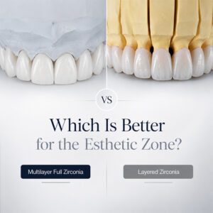Multilayer Full Zirconia vs Layered Zirconia